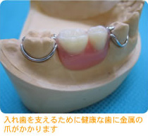 dentures_treatment_img002