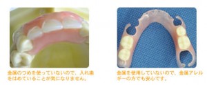 dentures_treatment_img004