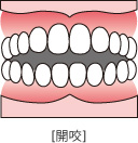 orthodontic_img003