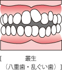 orthodontic_img004
