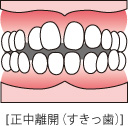 orthodontic_img005